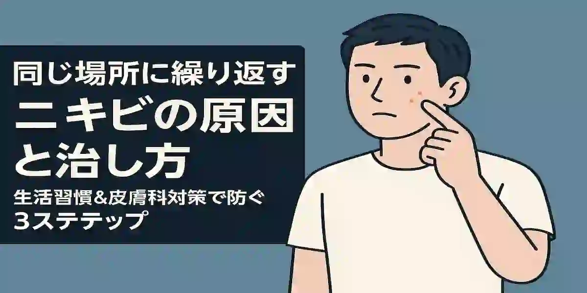 「同じ場所に繰り返すニキビの原因と治し方｜生活習慣＆皮膚科対策で防ぐ3ステップ」のアイキャッチ画像